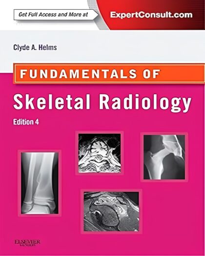 Fundamentals of skeletal radiology